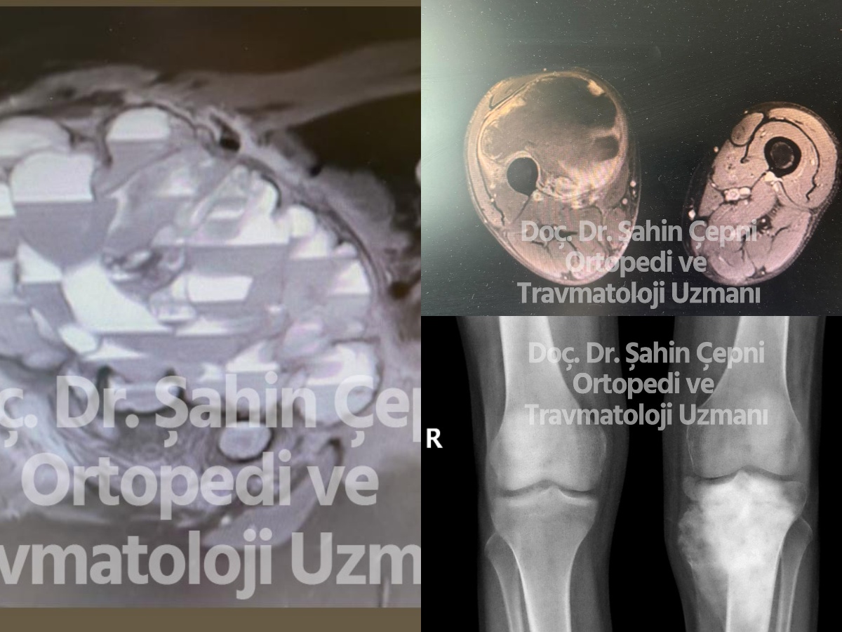Ankara en iyi ortopedi doktoru yorumları